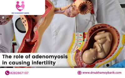 The Role of Adenomyosis in Causing Infertility