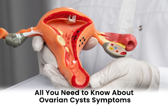 All You Need to Know About Ovarian Cysts Symptoms