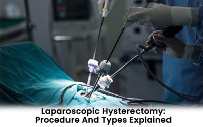 Laparoscopic Hysterectomy: Procedure And Types Explained