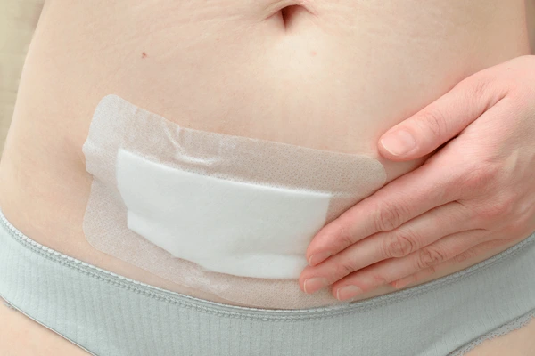 C-section surgery